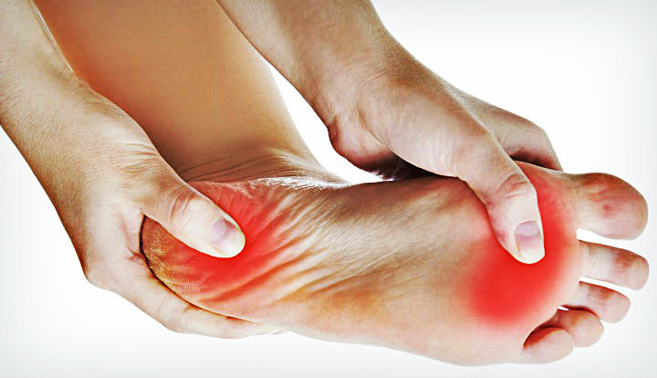 Fascitis_Plantar