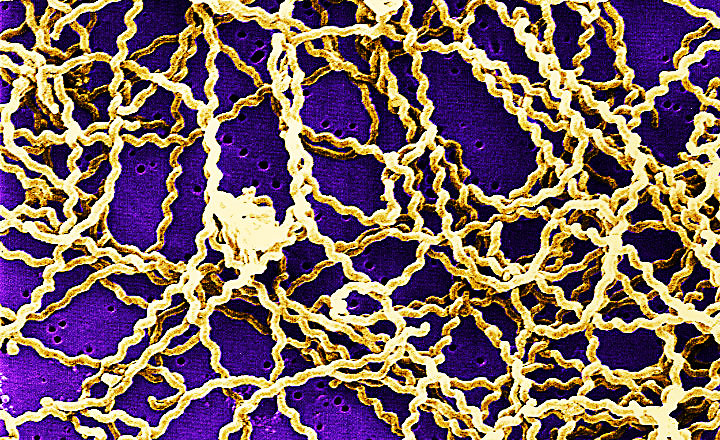 Leptospirosis